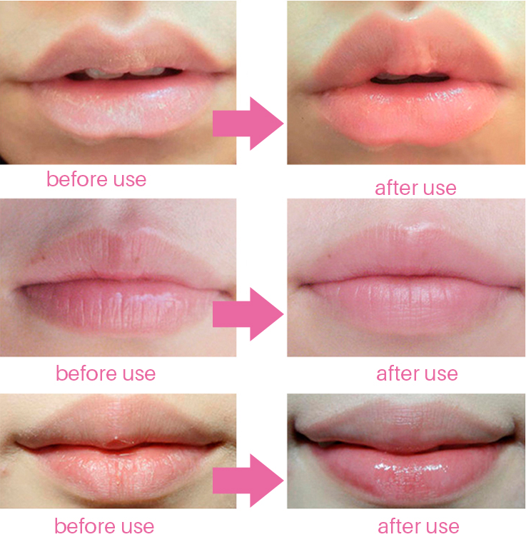 Collagen Lip Mask